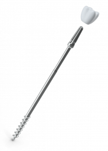 Implant zigomàtic a Lleida