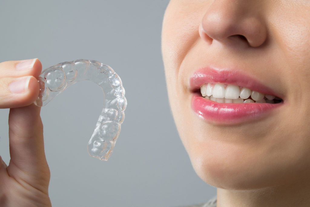Invisalign, el nuevo tratamiento de ortodoncia